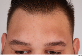 Ronaldo Biggato forehead head 0001.jpg